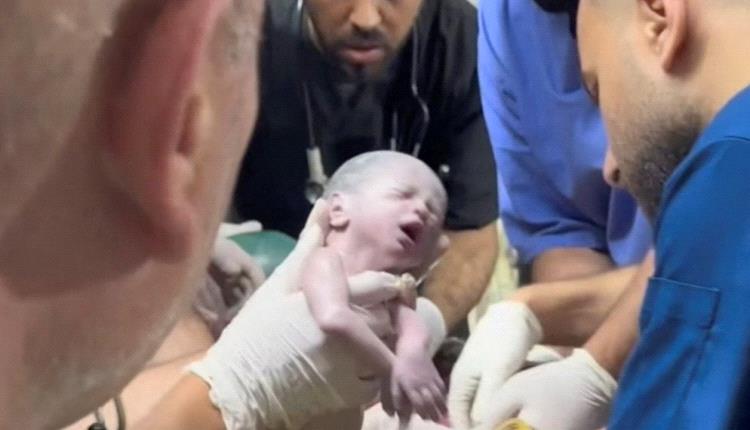 الحياة من رحم الموت.. ولادة طفلة فلسطينية بعد استشهاد والدتها بغارة إسرائيـلية في غــزة