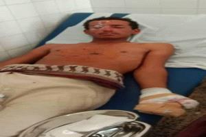 إصابة شاب بانفجار لغم حوثي في البيضاء بعد ساعات من حادثين مماثلين بتعز والحديدة