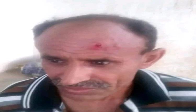 قيادي حوثي يمزق ميري رجل أمن من عهد النظام السابق قبل الاعتداء عليه بوحشية أمام السجناء