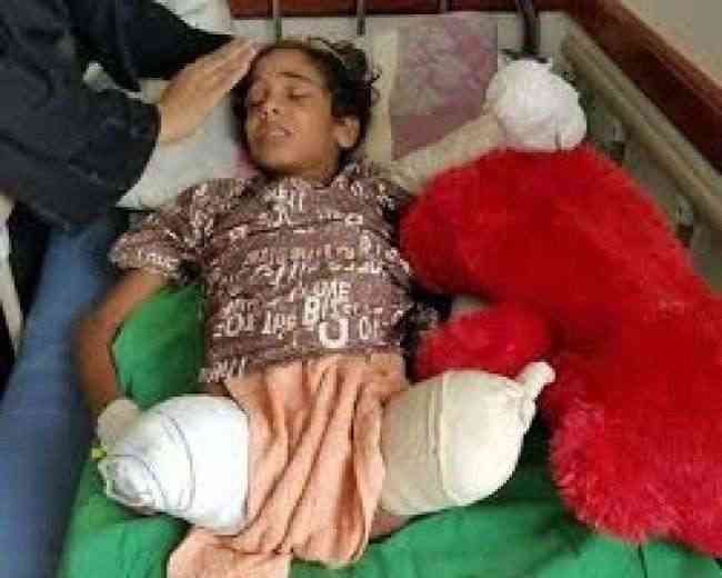 مركز الملك سلمان للإغاثة يبادر بعلاج طفل يمني بترت رجلاه ويده