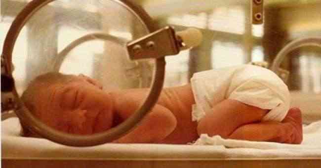 مشاكل الخصوبة تزيد من مخاطر ولادة طفل مبتسر أو يعاني تشوهات خلقية