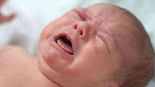 زيادة عالمية "مثيرة للقلق" في نسبة الولادة القيصرية