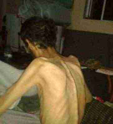 شاهد .. صورة مرعبة وصادمة ومفزعة من داخل أحد سجون الحوثي