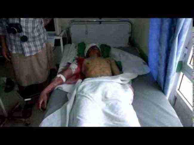 إب: مستشفى الثورة يستقبل 13 قتيلاً وجريحاً حوثيا وتشييع 7 آخرين