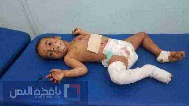 إصابة طفلان بمقذوف حوثي على منزل في قرية الغيل بالجوف .. صورة