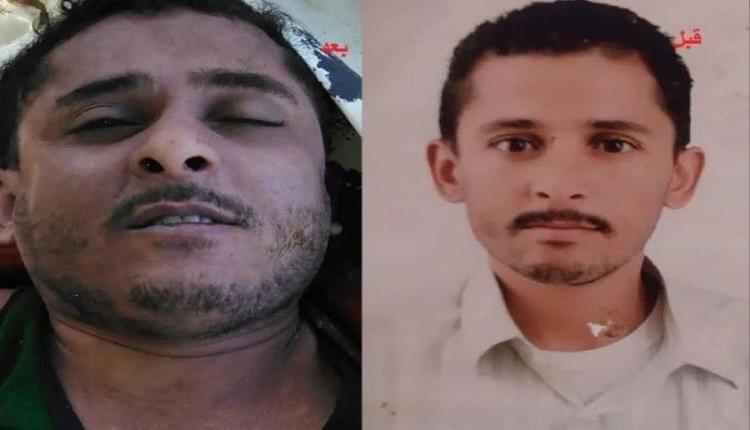 وفاة معتقل داخل سجن الحوثيين بصنعاء