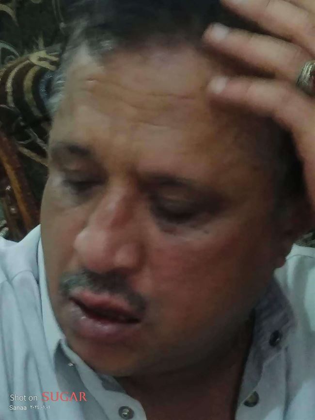 مراسل وكالة أمريكية يعلق توحش مخابرات الحوثي على الصمدي في صنعاء.. للمرة الـ2 يعتدوا عليه