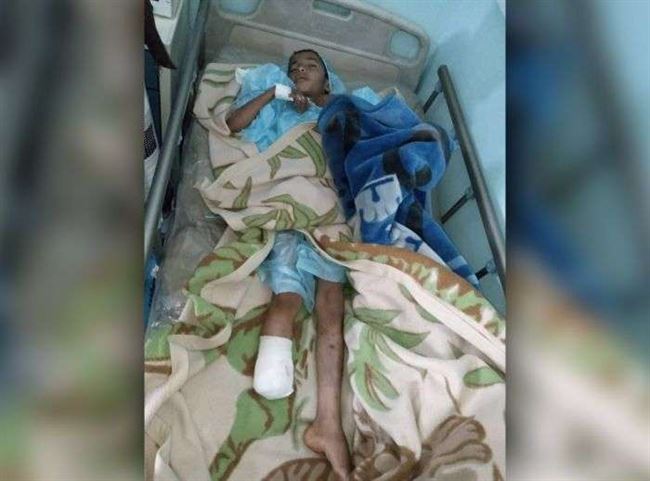 أشواك الموت الحوثية تتسبب ف بتر قدم طفل في البيضاء