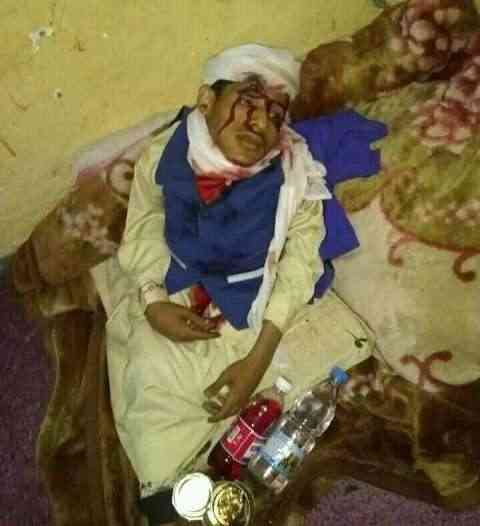 قدم له واجب الضيافة وقام بقتلة بطريقة وحشية .. جريمة قتل تهز الرأي العام اليمني