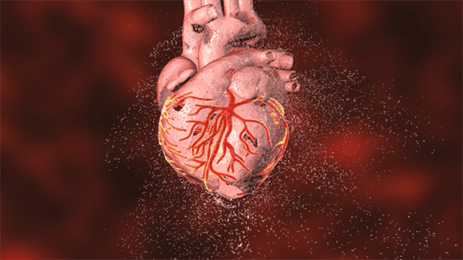 دراسة تكشف عن أضرار في القلب لدى نصف الذين أصيبوا بفيروس كورونا
