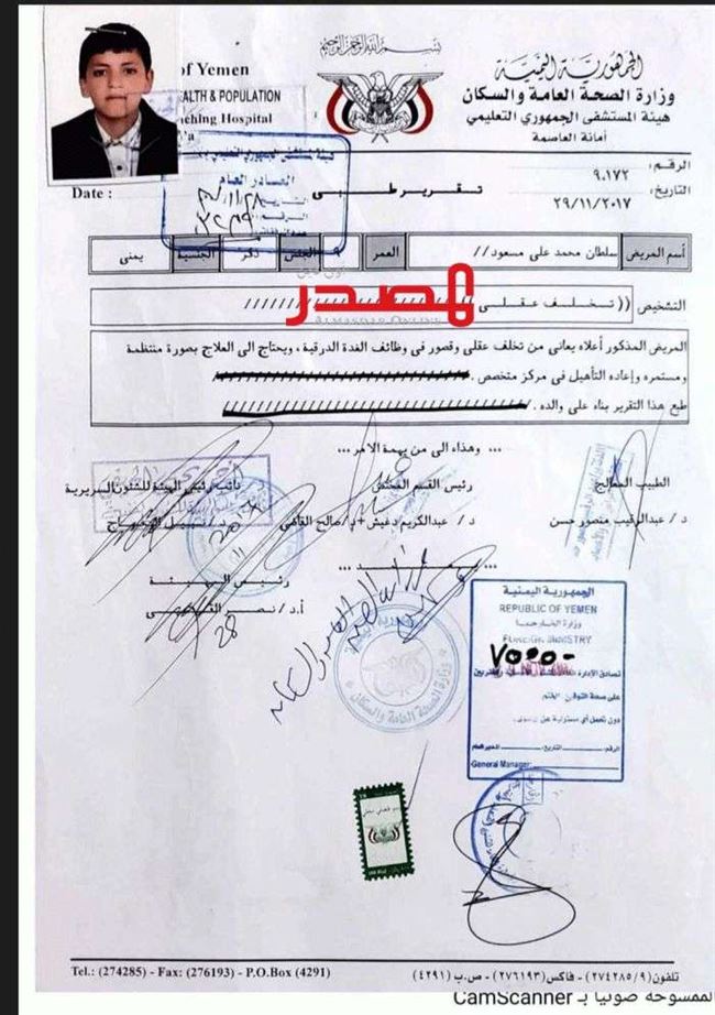 الحوثي يزج بطفل معاق ذهنيا في سجونه بالبيضاء منذ يومين