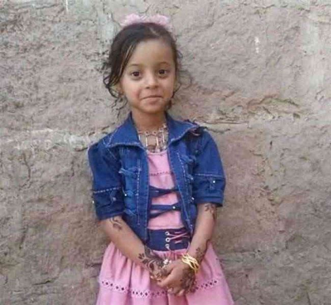 اختطاف طفلة من أمام منزلها في إب
