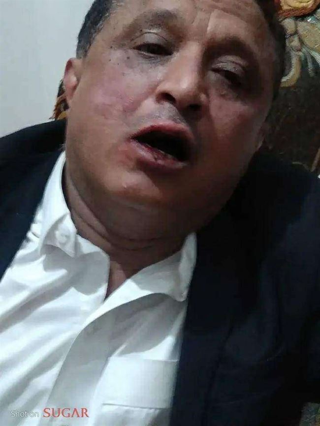 وحشية ضرب صحفي صنعاء تثير الشارع اليمني والعربي والبخيتي يكشف بالدليل القيادي المتورط