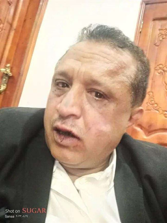 نقابة الصحفيين اليمنيين تحمل الحوثي المسؤلية الكاملة عن حياة وسلامة الصمدي بصنعاء
