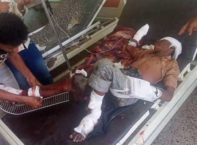 حوثي يبتر كفي طفل واحدى ساقيه جنوب الحديدة