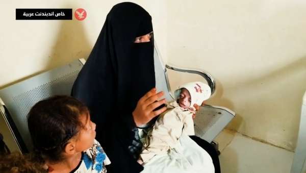 فقدان الوزن وانخفاض الدم.. "الهزال" يلاحق 100 ألف طفل يمني تحت الحصار الحوثي