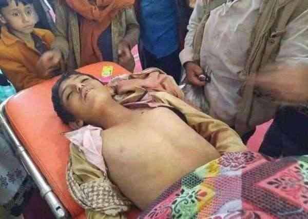 الحوثي يقنص طفل في الضالع ويرديه قتيلا جوار منزله