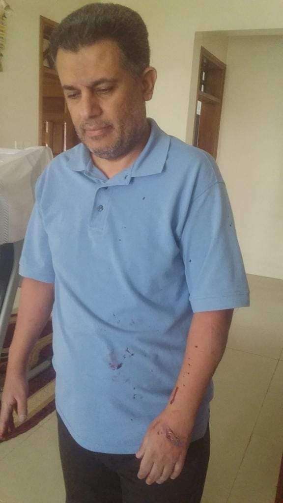 بعد الاعتداء الوحشي.. الحوثي يجبر كبسي صنعاء توقيع هذا الشرط مقابل نيل الحرية