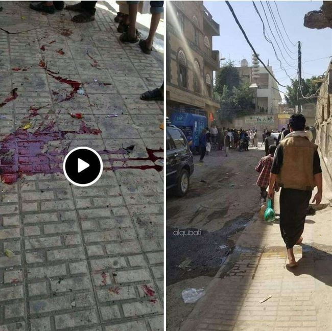 شاهد.. قتلى وجرحى باشتباكات مسلحة وانفجار قنبلة امام مدرسة بنات في صنعاء