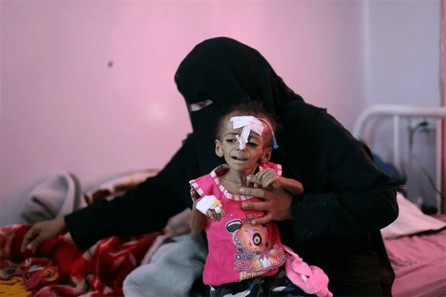 تحذيرات دولية من انهيار النظم الاجتماعية والاقتصادية في اليمن