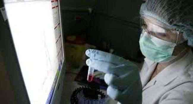 سنغافورة تعلن أول إصابة بفيروس جدري القردة النادر