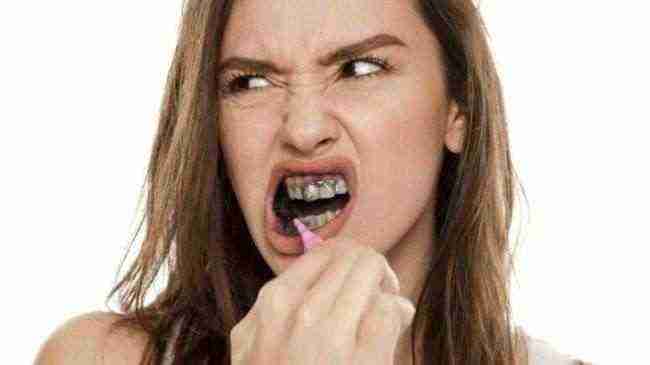 معجون الأسنان المصنوع من مسحوق الفحم "يزيد من خطر تآكلها"