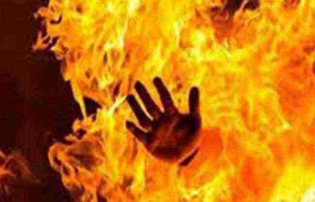 امرأة يمنية تحرق زوجها من أجل 500 ريال